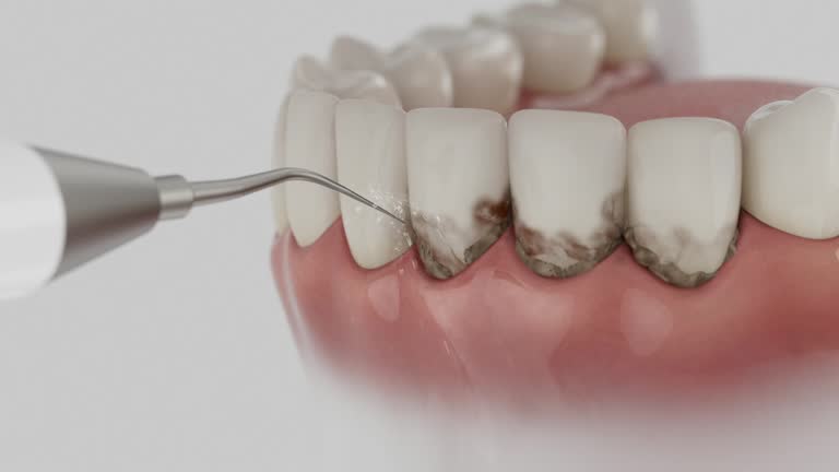 Reliable Dental contractor in Bedford, TX by Smile Center Dentistry